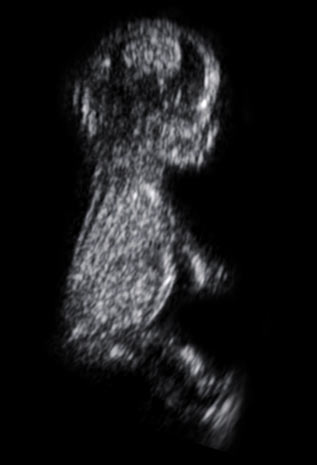 Ultrasound scan baby image
